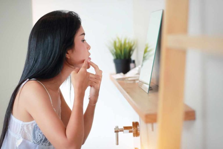 Cosa usare per trattare l’acne: rimedi, suggerimenti e consigli